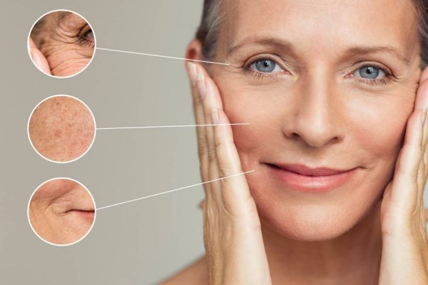 An Overview Of Thermage Treatment For Skin