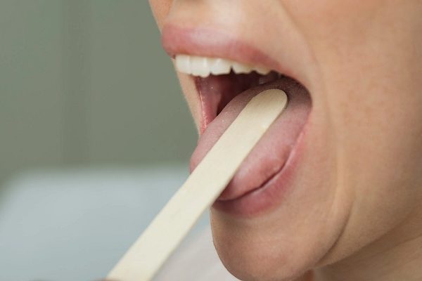 What are the symptoms of tongue infection?